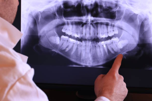 Best Walk-In Emergency Dentist in Evansville, WI