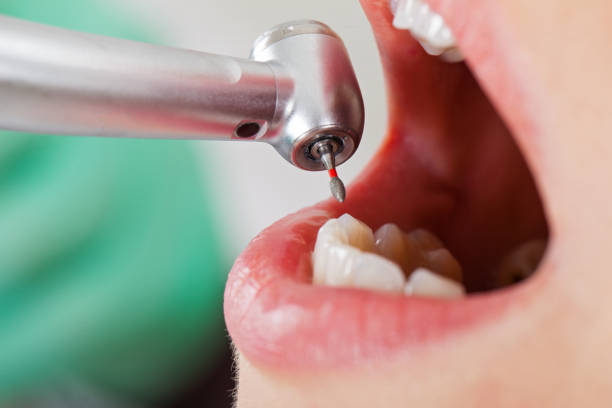 Best Emergency Dental Surgery in Evansville, WI